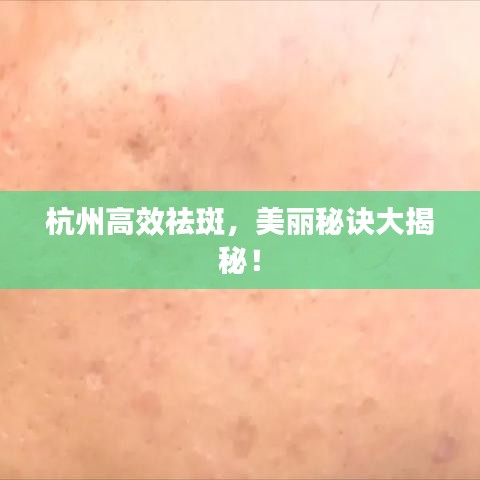 杭州高效祛斑，美麗秘訣大揭秘！