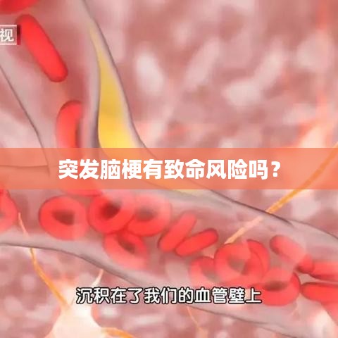 突發(fā)腦梗有致命風(fēng)險(xiǎn)嗎？